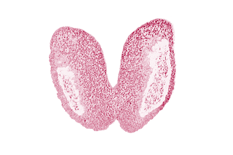 artifact space(s), chiasmatic plate (D1), head mesenchyme, junction of neural fold and surface ectoderm, neural fold [primordial diencephalon (D2)], neural fold [primordial telencephalon medium (T)], neural groove, optic nerve primordium (CN II) [primordial diencephalon (D1)], optic sulcus [primordial diencephalon (D1)], surface ectoderm of head, terminal notch