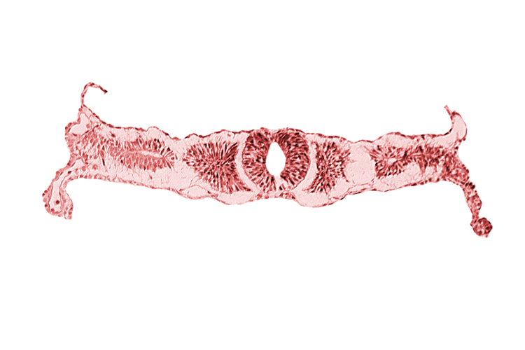 caudal end of somite 3 (O-3), dorsal aorta, endoderm, midgut, sulcus limitans, surface ectoderm