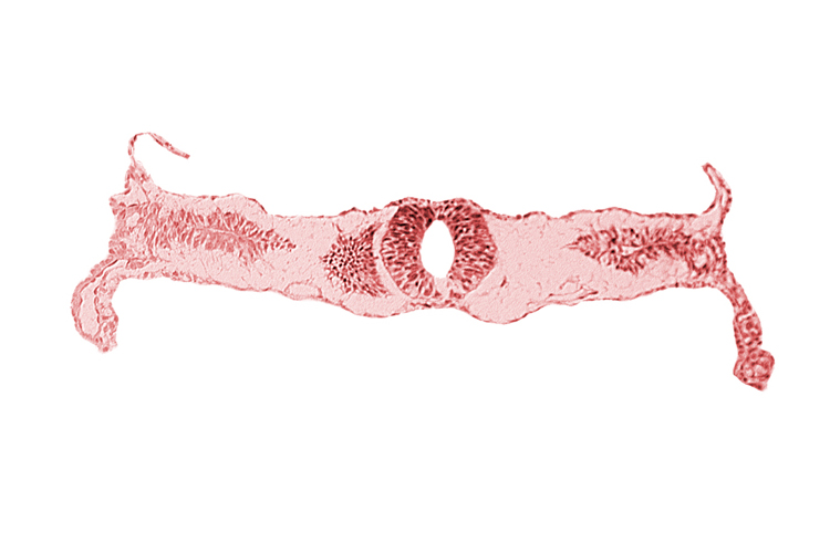 amnion attachment, amniotic cavity, extra-embryonic coelom, midgut, neural tube [rhombencephalon (Rh. D)], primordial peritoneal cavity, right umbilical vein, somite 3-4 intersegmental region, umbilical vesicle cavity, umbilical vesicle wall