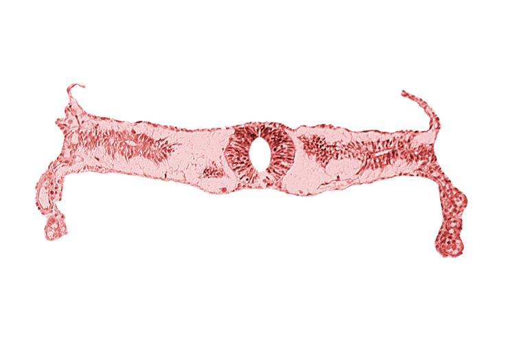 extra-embryonic coelom, midgut, neural tube [rhombencephalon (Rh. D)], somite 3-4 intersegmental region