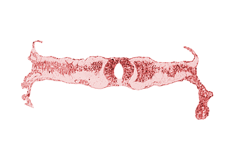 cephalic part of somite 4 (O-4), midgut, neural fold [rhombencephalon (Rh. D)], right umbilical vein