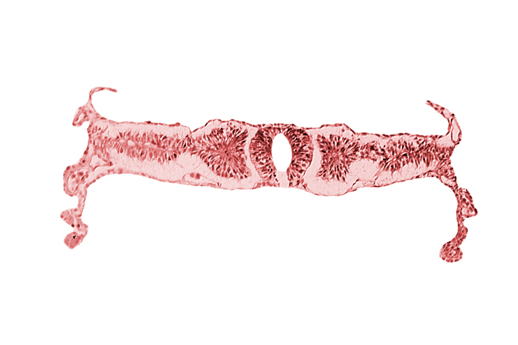 artifact separation(s), dorsal aorta, intermediate mesenchyme, midgut, neural fold [rhombencephalon (Rh. D)], somite 4 (O-4)