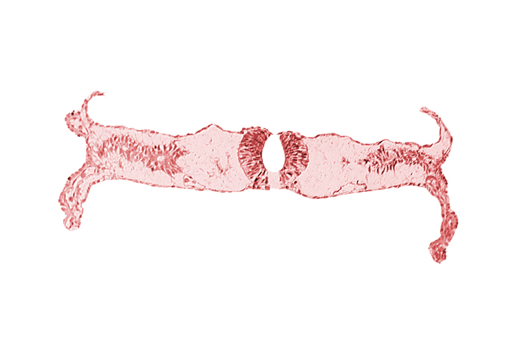 amnion attachment, dorsal aorta, midgut, neural fold (spinal cord), somite 4-5 intersegmental region, umbilical vesicle wall