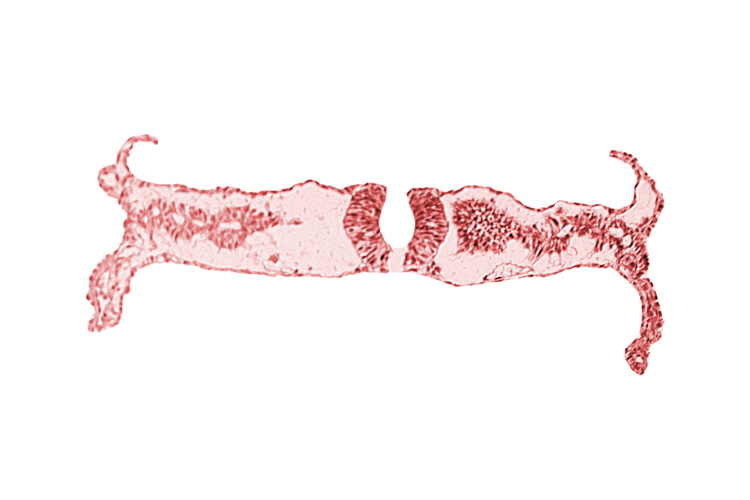 cephalic edge of caudal neuropore, cephalic part of somite 5 (C-1), dorsal aorta, midgut, neural fold (spinal cord), primordial peritoneal cavity