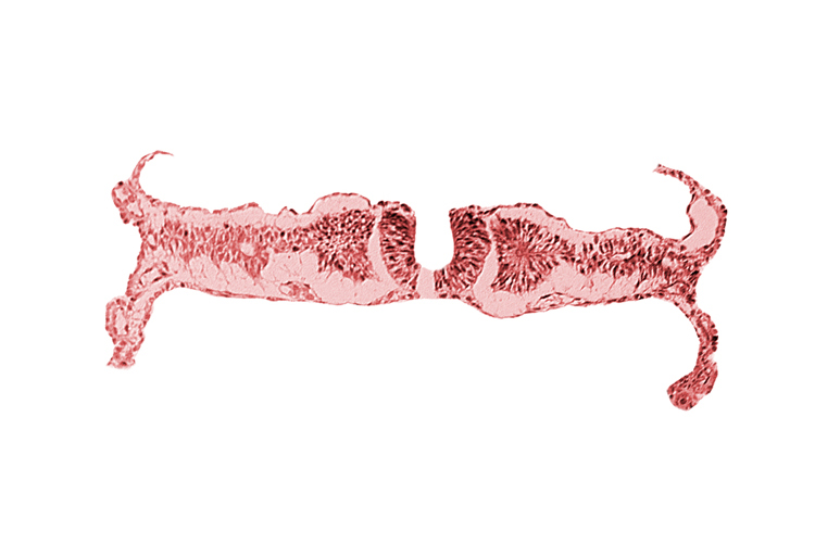 amniotic cavity, artifact separation(s), extra-embryonic coelom, intermediate mesenchyme, midgut, primordial peritoneal cavity, somite 5 (C-1), umbilical vesicle cavity