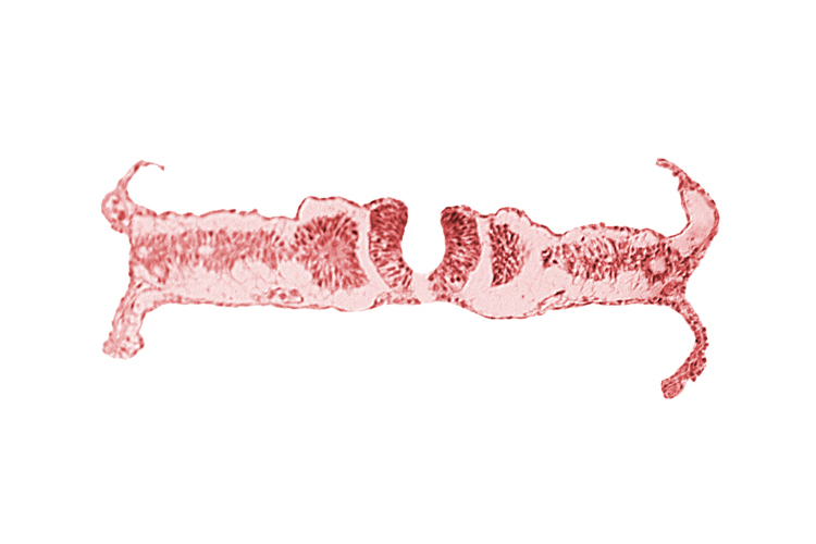 caudal edge of somite 5 (C-1), caudal neuropore, nephrogenic cord