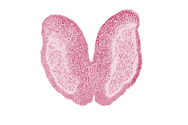 amniotic cavity, artifact space(s), cephalic neuropore, chiasmatic plate (D1), head mesenchyme, junction of neural fold and surface ectoderm, maxillary prominence of pharyngeal arch 1, neural fold [primordial diencephalon (D2)], neural fold [primordial telencephalon medium (T)], neural groove, surface ectoderm of head, terminal notch