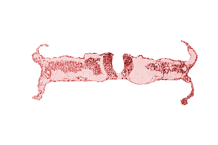 caudal neuropore, somite 5-6 intersegmental region