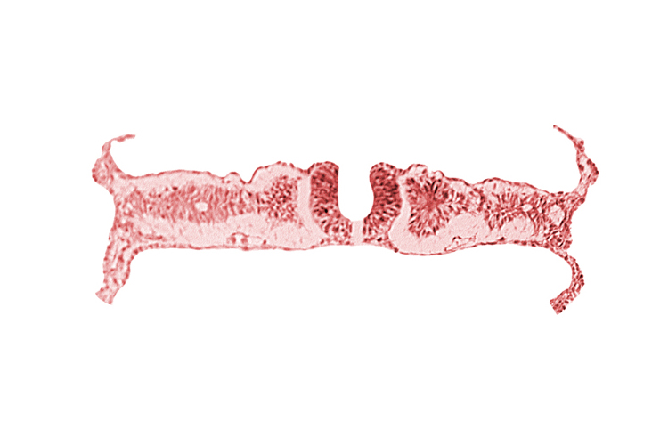 amnion attachment, amniotic cavity, caudal neuropore, dorsal aorta, extra-embryonic coelom, midgut, nephrogenic cord, right umbilical vein, somite 6 (C-2), somitocoel 6, umbilical vesicle cavity, umbilical vesicle wall