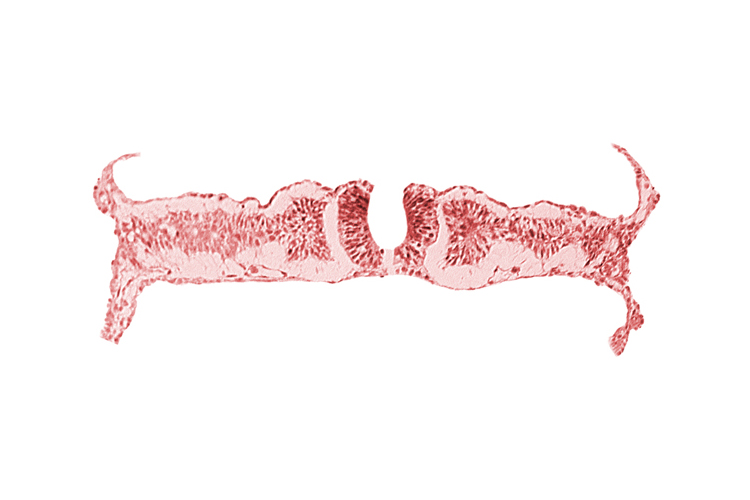 amnion attachment, amniotic cavity, caudal neuropore, dorsal aorta, extra-embryonic coelom, midgut, nephrogenic cord, right umbilical vein, somite 6 (C-2), somitocoel 6, umbilical vesicle cavity, umbilical vesicle wall