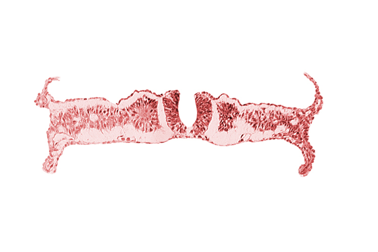 amnion, nephrogenic cord, notochordal plate, primordial peritoneal cavity, right umbilical vein, somite 6 (C-2), umbilical vesicle wall