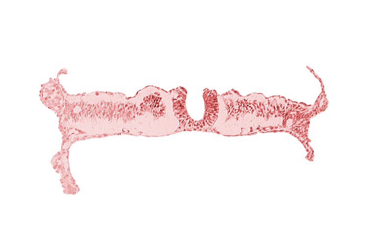 dorsal aorta, junction of neural ectoderm and surface ectoderm, lateral plate mesoderm, nephrogenic cord, neural fold, neural groove, notochordal plate, somite 7 (C-3), umbilical vesicle wall endoderm, umbilical vesicle wall mesoderm