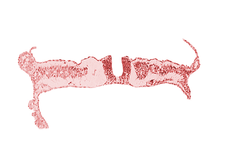 dorsal aorta, junction of neural ectoderm and surface ectoderm, lateral plate mesoderm, nephrogenic cord, neural fold, neural groove, notochordal plate, somite 7 (C-3), umbilical vesicle wall endoderm, umbilical vesicle wall mesoderm