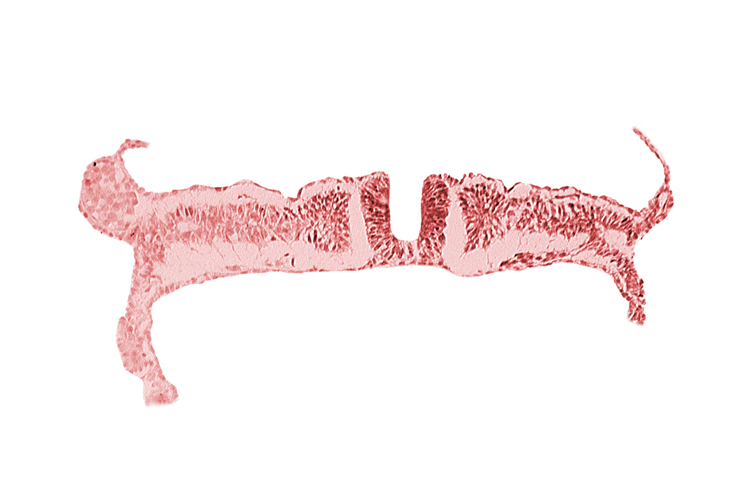 caudal neuropore, communication between primordial peritoneal cavity and extra-embryonic coelom, dorsal aorta, extra-embryonic coelom, primordial peritoneal cavity, somite 7 (C-3), somitocoel 7