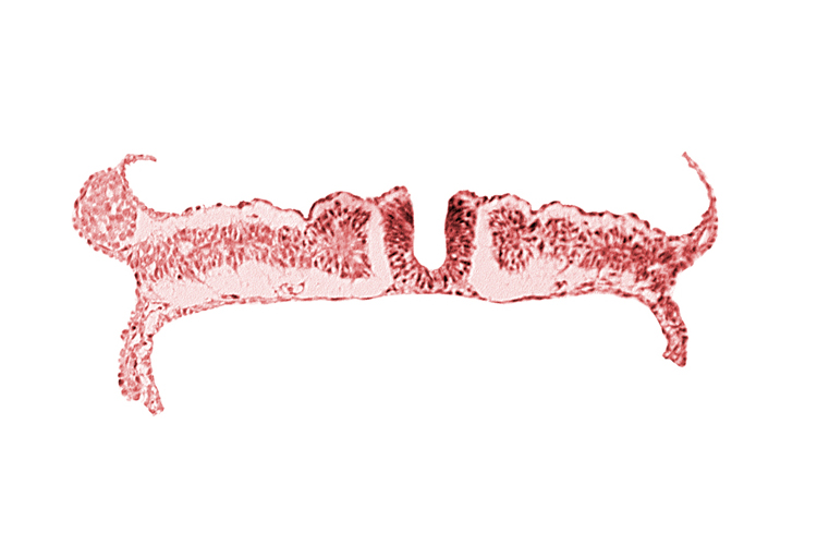 dorsal aorta, nephrogenic cord, somite 7 (C-3)