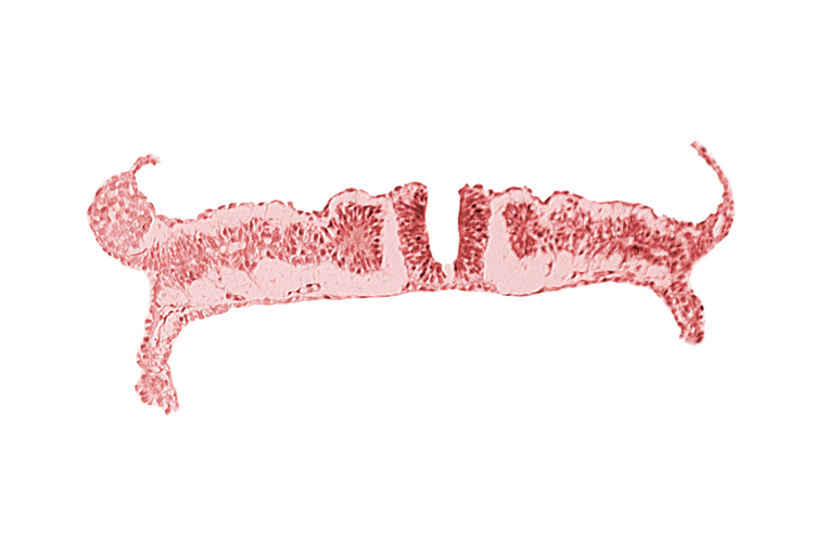 dorsal aorta, nephrogenic cord, somite 7 (C-3)