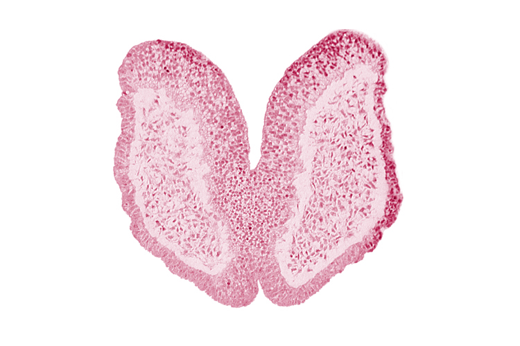 amniotic cavity, artifact space(s), chiasmatic plate (D1), head mesenchyme, junction of neural fold and surface ectoderm, maxillary prominence of pharyngeal arch 1, neural fold [primordial telencephalon medium (T)], surface ectoderm of head, terminal notch