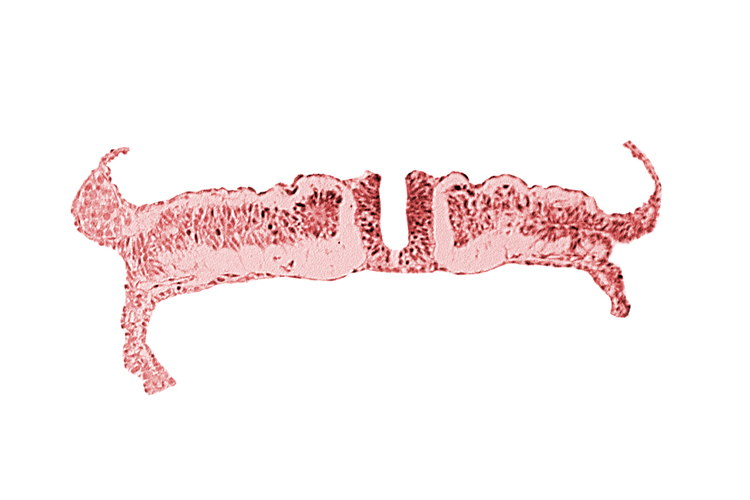 caudal neuropore, intermediate mesenchyme, lateral plate mesoderm, paraxial mesoderm, umbilical vesicle wall endoderm, umbilical vesicle wall mesoderm