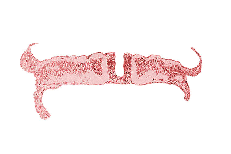 caudal neuropore, intermediate mesenchyme, lateral plate mesoderm, paraxial mesoderm, umbilical vesicle wall endoderm, umbilical vesicle wall mesoderm