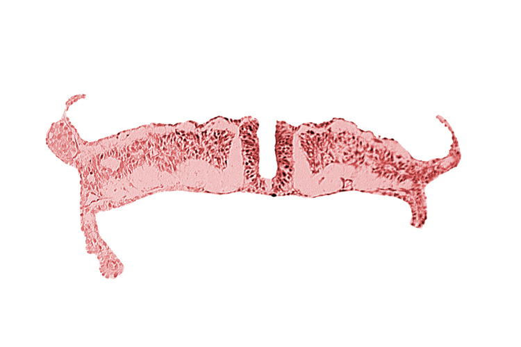 amnion attachment, amniotic cavity, dorsal aorta, neural fold, umbilical vesicle cavity, umbilical vesicle wall