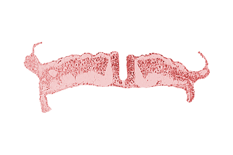 caudal neuropore, dorsal aorta