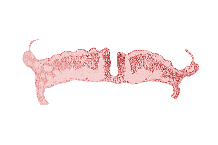 amniotic cavity, caudal neuropore, midgut, umbilical vesicle cavity