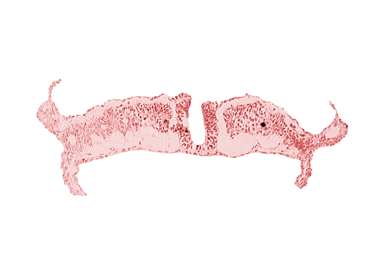 caudal neuropore, endoderm, intermediate mesenchyme, lateral plate mesoderm, paraxial mesoderm, surface ectoderm