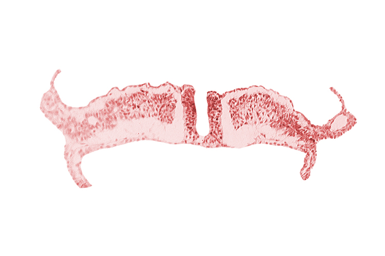 endoderm, intermediate mesenchyme, paraxial mesoderm, primordial peritoneal cavity, somatopleuric mesoderm, splanchnopleuric mesoderm, surface ectoderm