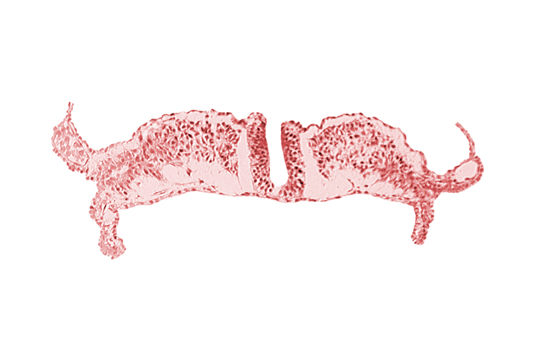 cephalic part of primordial lateral body fold, neural plate, paraxial mesoderm, splanchnopleuric mesoderm