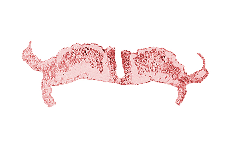 amniotic cavity, caudal neuropore, communication between primordial peritoneal cavity and extra-embryonic coelom, dorsal aorta plexus, umbilical vesicle cavity