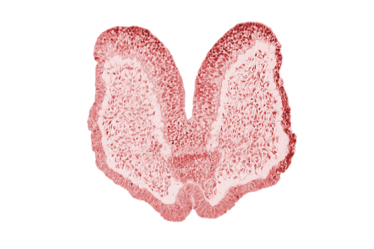 adenohypophysial primordium, artifact space(s), caudal edge of chiasmatic plate (D1), cephalic edge of aortic arch 1, head mesenchyme, neural fold [primordial diencephalon (D2)], neural groove, neurohypophysial primordium, prechordal plate (oropharyngeal membrane), stomodeum, surface ectoderm