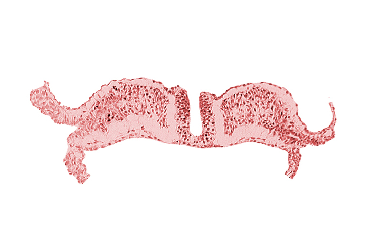 amniotic cavity, caudal neuropore, communication between primordial peritoneal cavity and extra-embryonic coelom, dorsal aorta plexus, umbilical vesicle cavity
