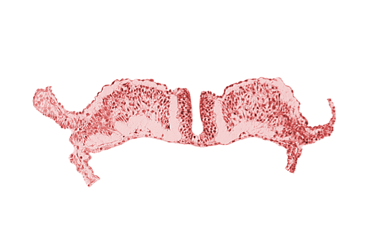 amniotic cavity, caudal neuropore, dorsal aorta plexus, umbilical vesicle cavity