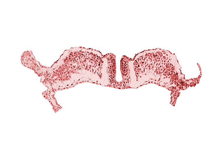 amniotic cavity, dorsal aorta plexus, extra-embryonic coelom, primordial lateral body fold, umbilical vesicle cavity