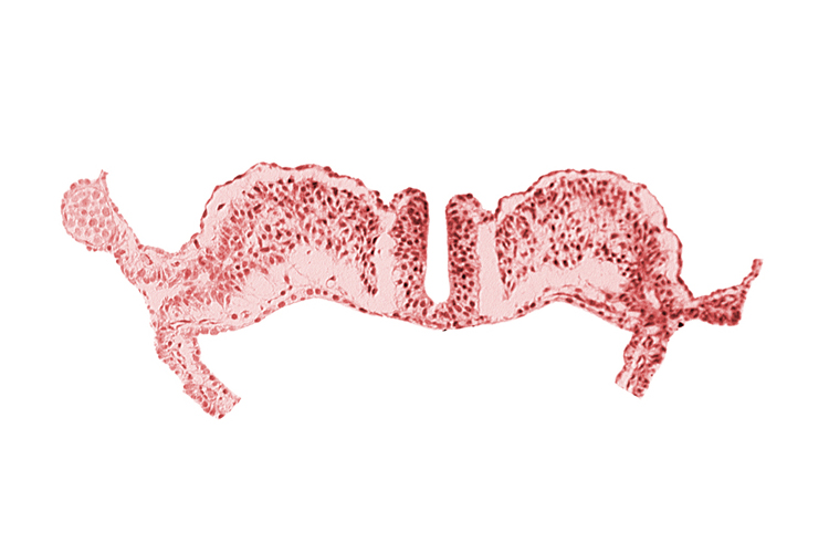 amniotic cavity, communication between primordial peritoneal cavity and extra-embryonic coelom, dorsal aorta plexus, midgut, notochordal plate