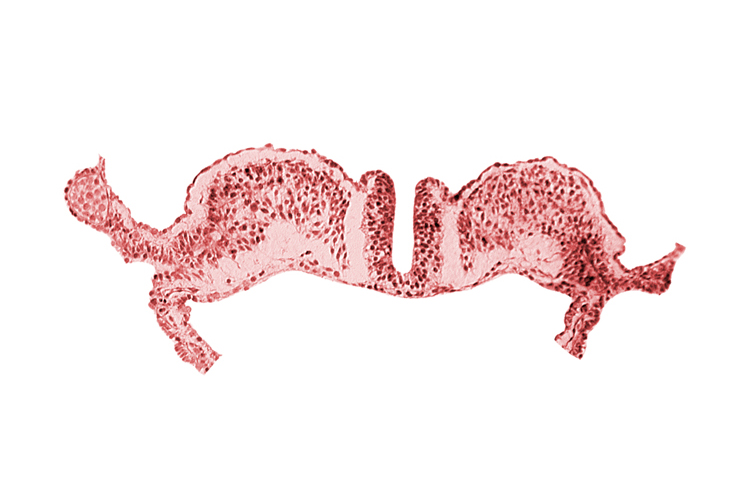 dorsal aorta plexus, notochordal plate, surface ectoderm