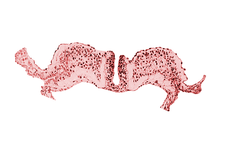 endoderm, neural fold, notochordal plate, primordial lateral body fold, surface ectoderm