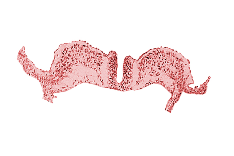 caudal neuropore, dorsal aorta plexus, midgut, primordial lateral body fold, surface ectoderm