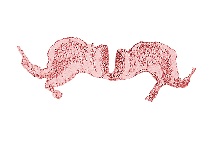 caudal neuropore, communication between primordial peritoneal cavity and extra-embryonic coelom, primordial lateral body fold