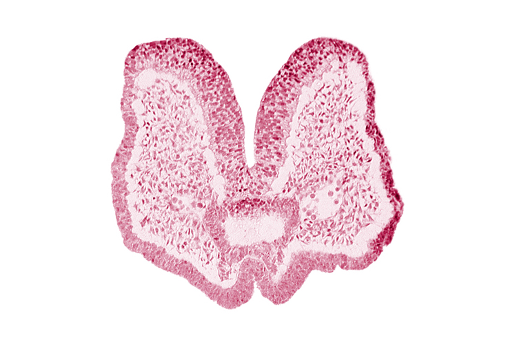 aortic arch 1, artifact space(s), cephalic neuropore, cephalic part of foregut, mandibular prominence of pharyngeal arch 1, mesencephalic neural crest, neural fold [mesencephalon (M)], neural groove (postoptic recess), notochordal plate, prechordal plate (oropharyngeal membrane), region of mesencephalic (cephalic) flexure, stomodeum, surface ectoderm
