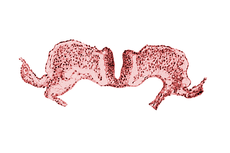 amnion attachment, amniotic cavity, midgut, primordial lateral body fold, umbilical vesicle cavity