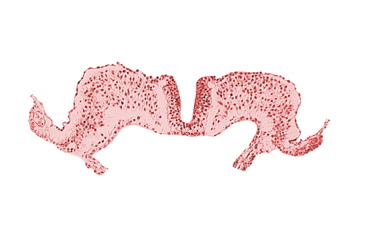amnion attachment, amniotic cavity, caudal neuropore, primordial lateral body fold, umbilical vesicle cavity