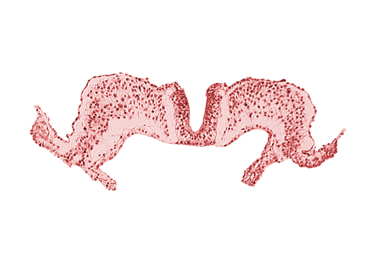 amnion attachment, amniotic cavity, caudal neuropore, primordial lateral body fold