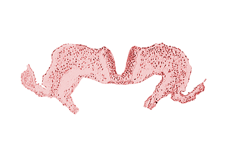 amniotic cavity, caudal neuropore, midgut, notochordal plate, primordial lateral body fold