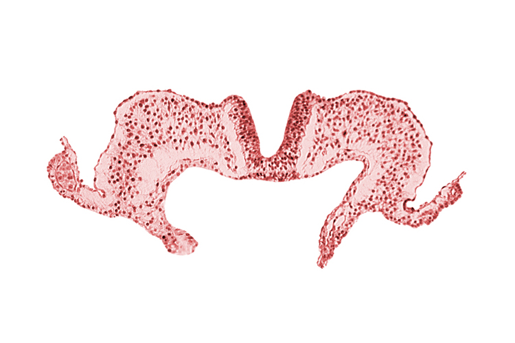 amniotic cavity, caudal neuropore, midgut, primordial lateral body fold