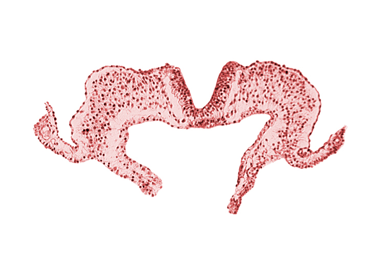 caudal neuropore, midgut, notochordal plate, primordial lateral body fold, surface ectoderm