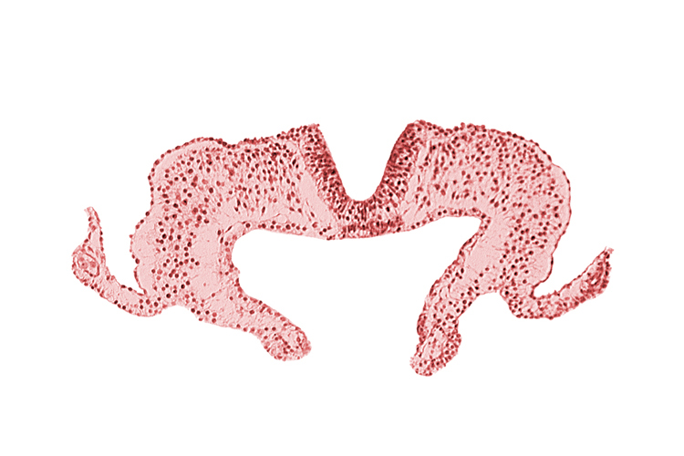 endoderm, mesoderm, midgut, neural fold, neural groove, notochordal plate, primordial lateral body fold, surface ectoderm