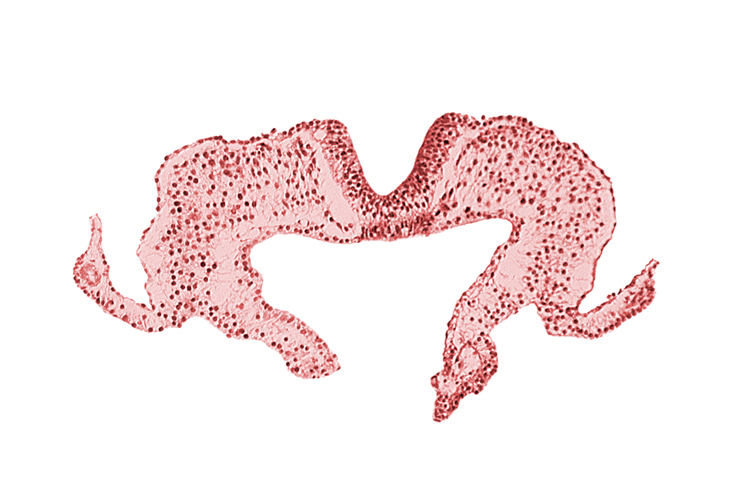 caudal part of notochordal plate, mesoderm, neural fold, neural groove, primordial lateral body fold, surface ectoderm