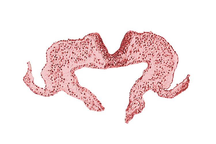 caudal edge of notochordal plate, mesoderm, midgut, neural fold, neural groove, primordial lateral body fold, surface ectoderm