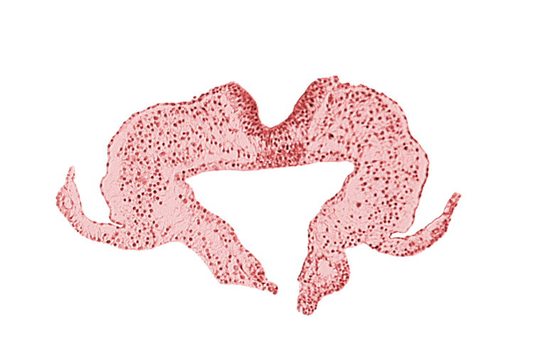 mesoderm, midgut, neural fold, neural groove, primordial lateral body fold, surface ectoderm